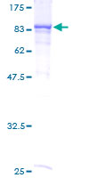 ab163216 on a 12.5% SDS-PAGE stained with Coomassie Blue.