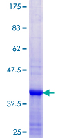 ab163217 on a 12.5% SDS-PAGE stained with Coomassie Blue.