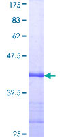 ab152911 on a 12.5% SDS-PAGE stained with Coomassie Blue.