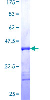 ab152912 on a 12.5% SDS-PAGE stained with Coomassie Blue.