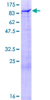 ab161776 on a 12.5% SDS-PAGE stained with Coomassie Blue.