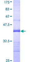 ab161777 on a 12.5% SDS-PAGE stained with Coomassie Blue.