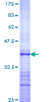 ab159352 on a 12.5% SDS-PAGE stained with Coomassie Blue.