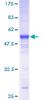 ab159351 on a 12.5% SDS-PAGE stained with Coomassie Blue.