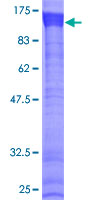 ab164522 on a 12.5% SDS-PAGE stained with Coomassie Blue.
