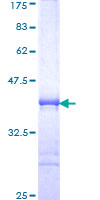 ab164523 on a 12.5% SDS-PAGE stained with Coomassie Blue.