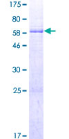 ab165692 on a 12.5% SDS-PAGE stained with Coomassie Blue.