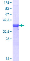 ab159353 on a 12.5% SDS-PAGE stained with Coomassie Blue.