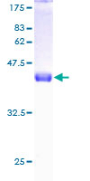 ab159157 on a 12.5% SDS-PAGE stained with Coomassie Blue.