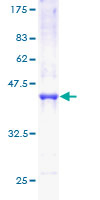 ab159154 on a 12.5% SDS-PAGE stained with Coomassie Blue.