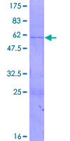 ab153634 on a 12.5% SDS-PAGE stained with Coomassie Blue.