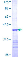 ab153635 on a 12.5% SDS-PAGE stained with Coomassie Blue.