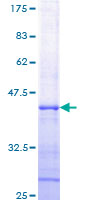 ab152657 on a 12.5% SDS-PAGE stained with Coomassie Blue.