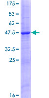 ab165186 on a 12.5% SDS-PAGE stained with Coomassie Blue.