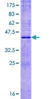 ab165187 on a 12.5% SDS-PAGE stained with Coomassie Blue.