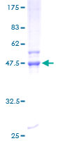 ab159951 on a 12.5% SDS-PAGE stained with Coomassie Blue.