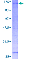 ab160715 on a 12.5% SDS-PAGE stained with Coomassie Blue.