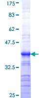 ab160716 on a 12.5% SDS-PAGE stained with Coomassie Blue.