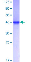 ab153277 on a 12.5% SDS-PAGE stained with Coomassie Blue.