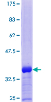 ab153278 on a 12.5% SDS-PAGE stained with Coomassie Blue.