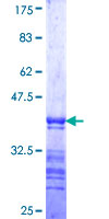 ab162838 on a 12.5% SDS-PAGE stained with Coomassie Blue.