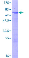 ab165445 on a 12.5% SDS-PAGE stained with Coomassie Blue.