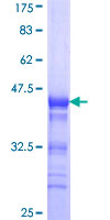 ab165446 on a 12.5% SDS-PAGE stained with Coomassie Blue.