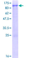 ab162428 on a 12.5% SDS-PAGE stained with Coomassie Blue.