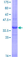 ab163056 on a 12.5% SDS-PAGE stained with Coomassie Blue.