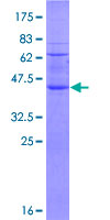 ab164135 on a 12.5% SDS-PAGE stained with Coomassie Blue.