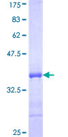 ab164136 on a 12.5% SDS-PAGE stained with Coomassie Blue.