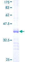 ab162904 on a 12.5% SDS-PAGE stained with Coomassie Blue.