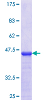 ab164041 on a 12.5% SDS-PAGE stained with Coomassie Blue.