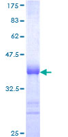 ab161422 on a 12.5% SDS-PAGE stained with Coomassie Blue.