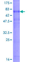 ab165800 on a 12.5% SDS-PAGE stained with Coomassie Blue.
