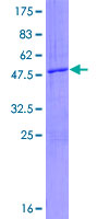 ab164552 on a 12.5% SDS-PAGE stained with Coomassie Blue.