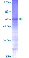 ab162554 on a 12.5% SDS-PAGE stained with Coomassie Blue.