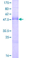 ab162555 on a 12.5% SDS-PAGE stained with Coomassie Blue.