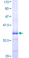 ab162556 on a 12.5% SDS-PAGE stained with Coomassie Blue.