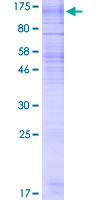 ab161365 on a 12.5% SDS-PAGE stained with Coomassie Blue.