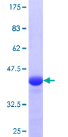 ab161366 on a 12.5% SDS-PAGE stained with Coomassie Blue.