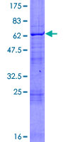 ab160566 on a 12.5% SDS-PAGE stained with Coomassie Blue.