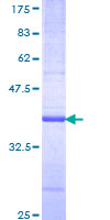 ab160567 on a 12.5% SDS-PAGE stained with Coomassie Blue.