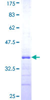 ab162375 on a 12.5% SDS-PAGE stained with Coomassie Blue.