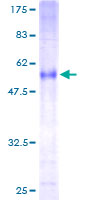 ab160650 on a 12.5% SDS-PAGE stained with Coomassie Blue.