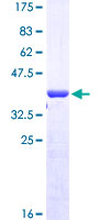 ab153535 on a 12.5% SDS-PAGE stained with Coomassie Blue.
