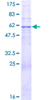 ab166393 on a 12.5% SDS-PAGE stained with Coomassie Blue.