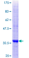 ab166394 on a 12.5% SDS-PAGE stained with Coomassie Blue.