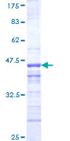 ab165042 on a 12.5% SDS-PAGE stained with Coomassie Blue.