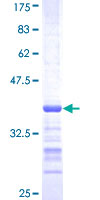 ab165669 on a 12.5% SDS-PAGE stained with Coomassie Blue.